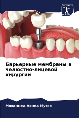 ibs