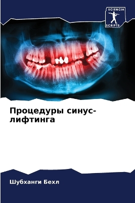 ibs