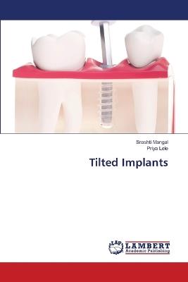 Tilted Implants - Srashti Mangal,Priya Lele - cover