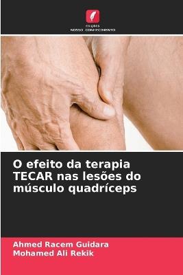 O efeito da terapia TECAR nas lesões do músculo quadríceps - Ahmed Racem Guidara,Mohamed Ali Rekik - cover
