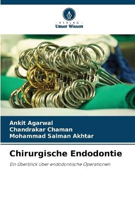 Chirurgische Endodontie - Ankit Agarwal,Chandrakar Chaman,Mohammad Salman Akhtar - cover