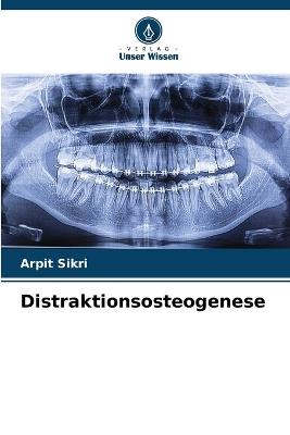 Distraktionsosteogenese - Arpit Sikri - cover