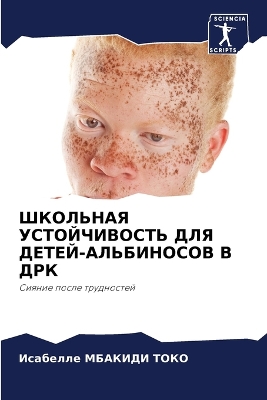 ibs