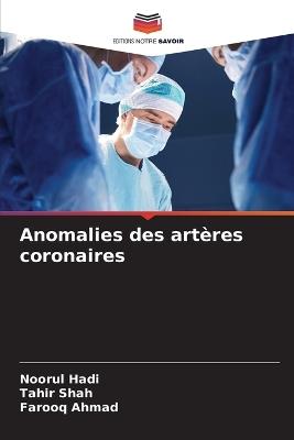 Anomalies des art?res coronaires - Noorul Hadi,Tahir Shah,Farooq Ahmad - cover