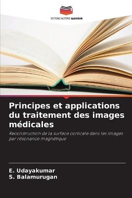 Principes et applications du traitement des images médicales - E Udayakumar,S Balamurugan - cover