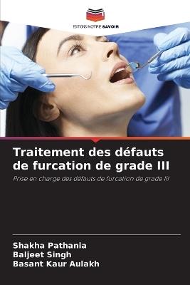 Traitement des d?fauts de furcation de grade III - Shakha Pathania,Baljeet Singh,Basant Kaur Aulakh - cover