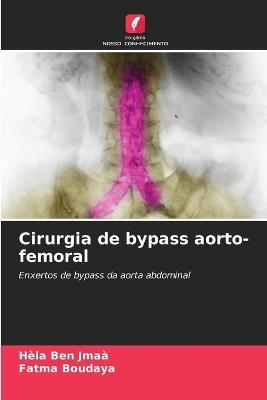 Cirurgia de bypass aorto-femoral - Hèla Ben Jmaà,Fatma Boudaya - cover