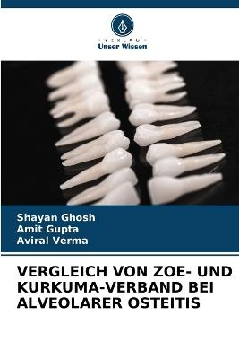 Vergleich Von Zoe- Und Kurkuma-Verband Bei Alveolarer Osteitis - Shayan Ghosh,Amit Gupta,Aviral Verma - cover