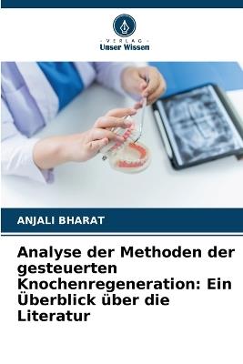 Analyse der Methoden der gesteuerten Knochenregeneration: Ein Überblick über die Literatur - Anjali Bharat - cover