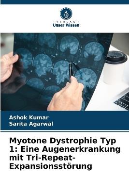 Myotone Dystrophie Typ 1: Eine Augenerkrankung mit Tri-Repeat-Expansionsstörung - Ashok Kumar,Sarita Agarwal - cover