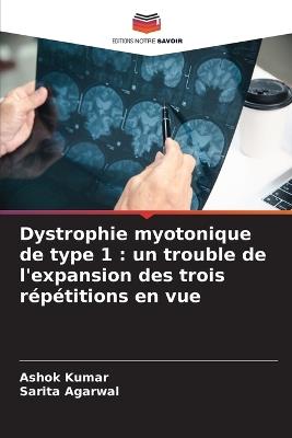Dystrophie myotonique de type 1: un trouble de l'expansion des trois répétitions en vue - Ashok Kumar,Sarita Agarwal - cover