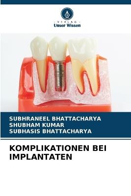 Komplikationen Bei Implantaten - Subhraneel Bhattacharya,Shubham Kumar,Subhasis Bhattacharya - cover