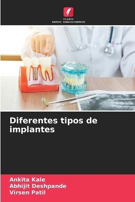 Diferentes tipos de implantes - Ankita Kale,Abhijit Deshpande,Virsen Patil - cover