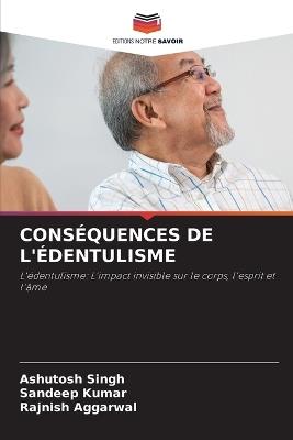 Conséquences de l'Édentulisme - Ashutosh Singh,Sandeep Kumar,Rajnish Aggarwal - cover