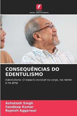 Consequências Do Edentulismo - Ashutosh Singh,Sandeep Kumar,Rajnish Aggarwal - cover
