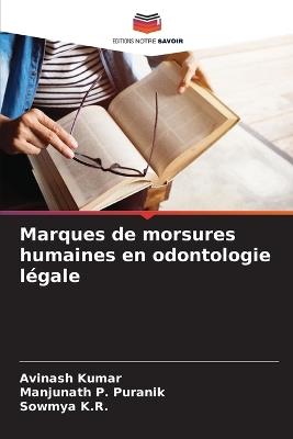 Marques de morsures humaines en odontologie légale - Avinash Kumar,Manjunath P Puranik,Sowmya K R - cover