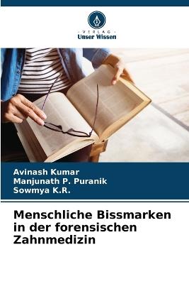 Menschliche Bissmarken in der forensischen Zahnmedizin - Avinash Kumar,Manjunath P Puranik,Sowmya K R - cover