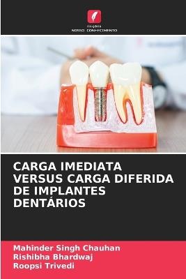Carga Imediata Versus Carga Diferida de Implantes Dentários - Mahinder Singh Chauhan,Rishibha Bhardwaj,Roopsi Trivedi - cover