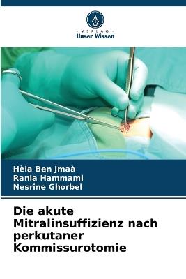 Die akute Mitralinsuffizienz nach perkutaner Kommissurotomie - Hèla Ben Jmaà,Rania Hammami,Nesrine Ghorbel - cover