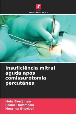 Insuficiência mitral aguda após comissurotomia percutânea - Hèla Ben Jmaà,Rania Hammami,Nesrine Ghorbel - cover