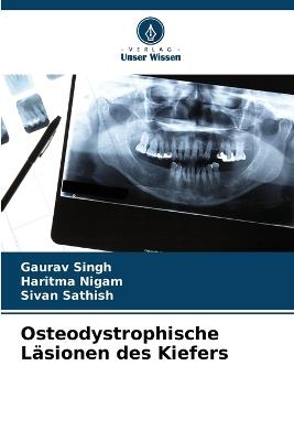 Osteodystrophische Läsionen des Kiefers - Gaurav Singh,Haritma Nigam,Sivan Sathish - cover