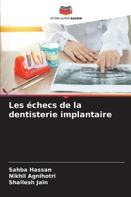 Les échecs de la dentisterie implantaire - Sahba Hassan,Nikhil Agnihotri,Shailesh Jain - cover