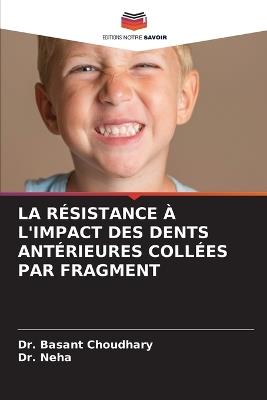 La Résistance À l'Impact Des Dents Antérieures Collées Par Fragment - Basant Choudhary,Neha - cover