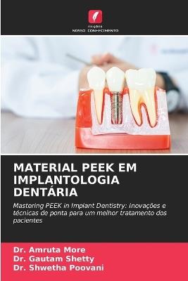 Material Peek Em Implantologia Dentária - Amruta More,Gautam Shetty,Shwetha Poovani - cover