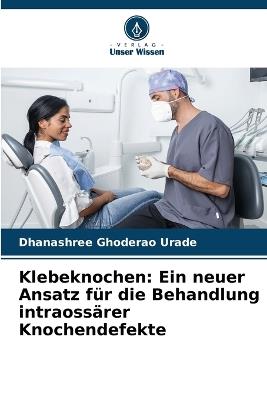 Klebeknochen: Ein neuer Ansatz für die Behandlung intraossärer Knochendefekte - Dhanashree Ghoderao Urade - cover