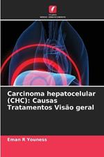 Carcinoma hepatocelular (CHC): Causas Tratamentos Visão geral
