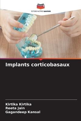 Implants corticobasaux - Kirtika Kirtika,Reeta Jain,Gagandeep Kansal - cover