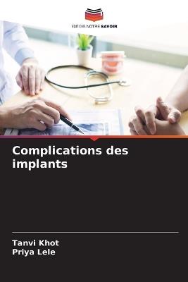 Complications des implants - Tanvi Khot,Priya Lele - cover