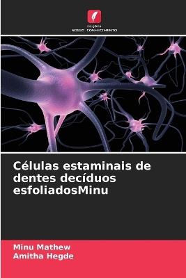 Células estaminais de dentes decíduos esfoliadosMinu - Minu Mathew,Amitha Hegde - cover