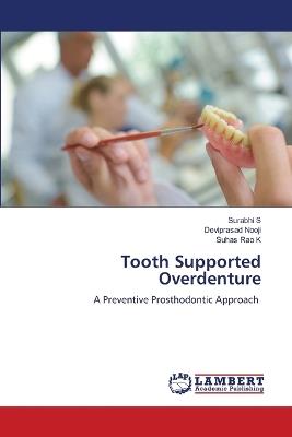 Tooth Supported Overdenture - Surabhi S,Deviprasad Nooji,Suhas Rao K - cover