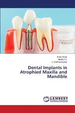 Dental Implants in Atrophied Maxilla and Mandible