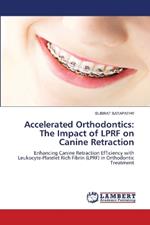 Accelerated Orthodontics: The Impact of LPRF on Canine Retraction