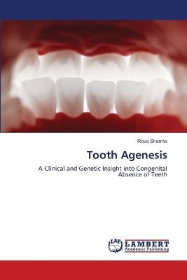 Tooth Agenesis - Reva Sharma - cover