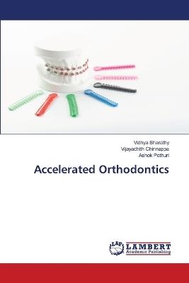 Accelerated Orthodontics - Vidhya Bharathy,Vijayadhith Chinnappa,Ashok Pothuri - cover