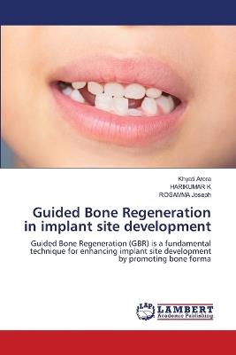 Guided Bone Regeneration in implant site development - Khyati Arora,Harikumar K,Rosamma Joseph - cover