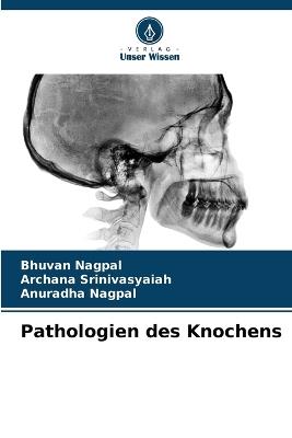 Pathologien des Knochens - Bhuvan Nagpal,Archana Srinivasyaiah,Anuradha Nagpal - cover