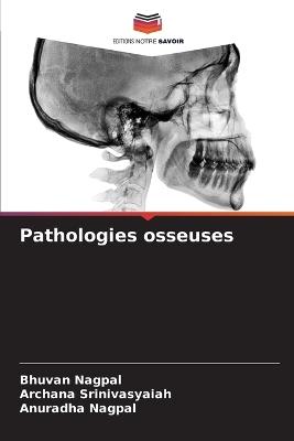 Pathologies osseuses - Bhuvan Nagpal,Archana Srinivasyaiah,Anuradha Nagpal - cover
