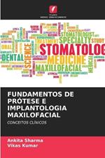Fundamentos de Prótese E Implantologia Maxilofacial