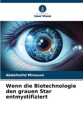 Wenn die Biotechnologie den grauen Star entmystifiziert - Abdelhafid Mimouni - cover