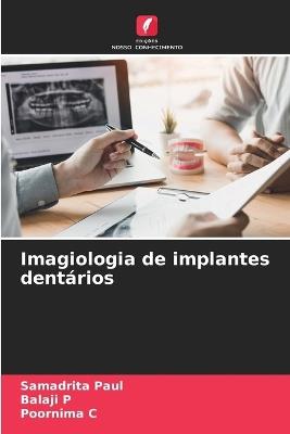 Imagiologia de implantes dentários - Samadrita Paul,Balaji P,Poornima C - cover