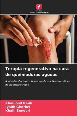 Terapia regenerativa na cura de queimaduras agudas - Khouloud Rmili,Iyadh Ghorbel,Khalil Ennouri - cover