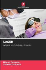 Laser