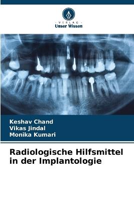 Radiologische Hilfsmittel in der Implantologie - Keshav Chand,Vikas Jindal,Monika Kumari - cover