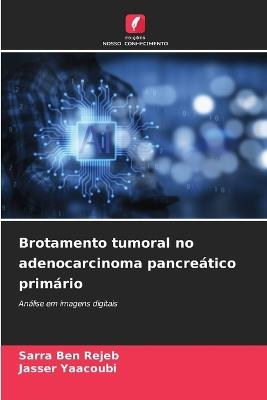 Brotamento tumoral no adenocarcinoma pancreático primário - Sarra Ben Rejeb,Jasser Yaacoubi - cover