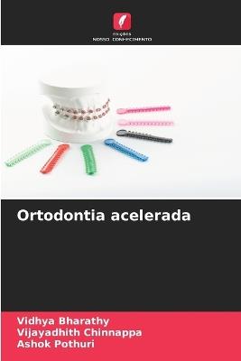 Ortodontia acelerada - Vidhya Bharathy,Vijayadhith Chinnappa,Ashok Pothuri - cover
