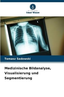 Medizinische Bildanalyse, Visualisierung und Segmentierung - Tomasz Sadowski - cover